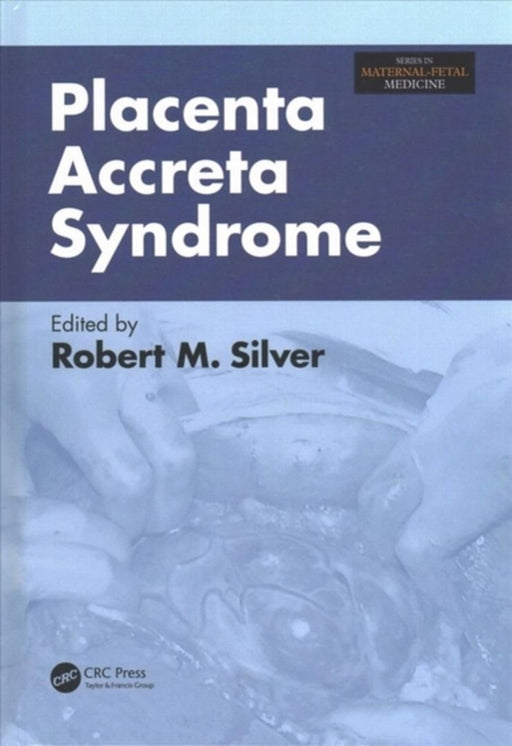 Placenta Accreta Syndrome by Robert Silver