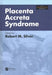 Placenta Accreta Syndrome by Robert Silver