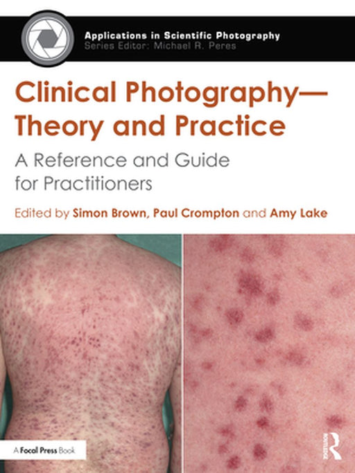 Clinical Photography -- Theory and Practice: A Reference and Guide for Practitioners by Simon Brown