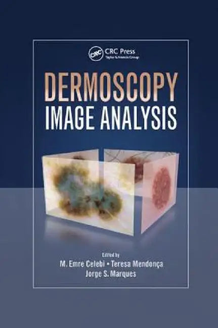 Dermoscopy Image Analysis by M. Emre Celebi