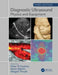 Diagnostic Ultrasound, Third Edition: Physics and Equipment by Peter Hoskins