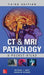 CT & MRI Pathology: A Pocket Atlas, Third Edition by Michael L. Grey