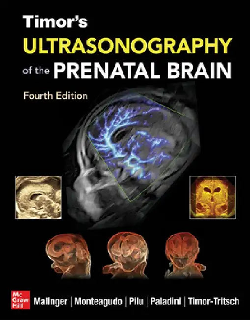 Timor's Ultrasonography of the Prenatal Brain, Fourth Edition by Gustavo Malinger