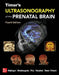 Timor's Ultrasonography of the Prenatal Brain, Fourth Edition by Gustavo Malinger