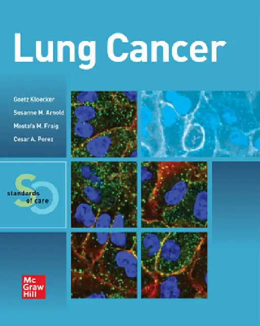 Lung Cancer: Standards of Care by Goetz Kloecker