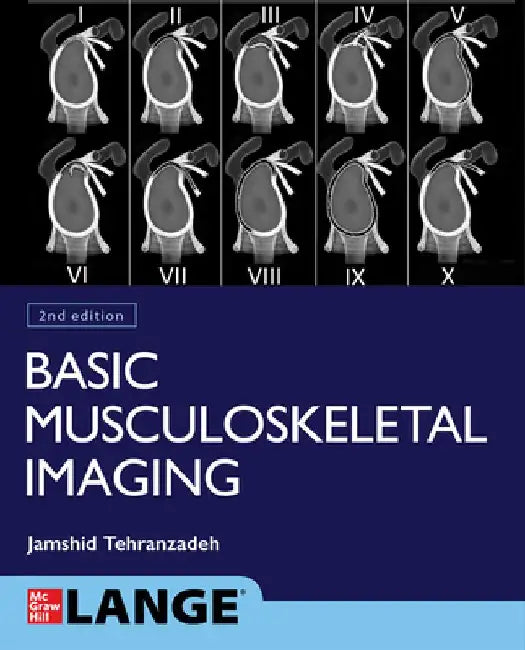 Basic Musculoskeletal Imaging, Second Edition by Jamshid Tehranzadeh