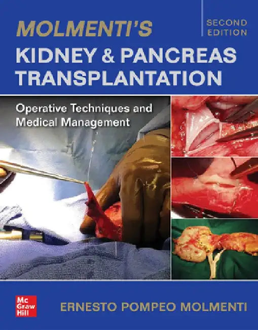 Molmenti's Kidney and Pancreas Transplantation: Operative Techniques and Medical Management by Ernesto P. Molmenti