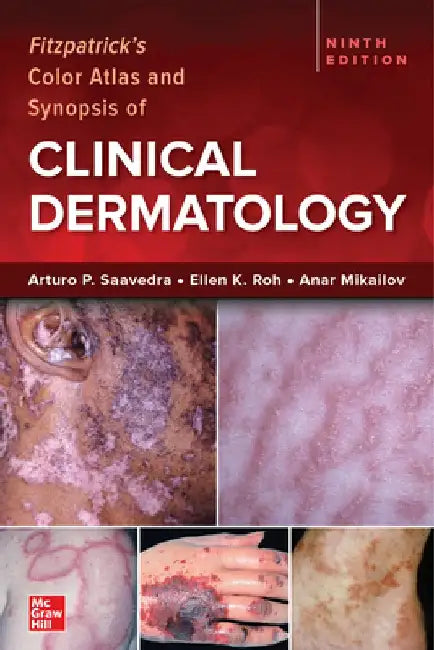 Fitzpatrick's Color Atlas and Synopsis of Clinical Dermatology, 9/E by Arturo Saavedra