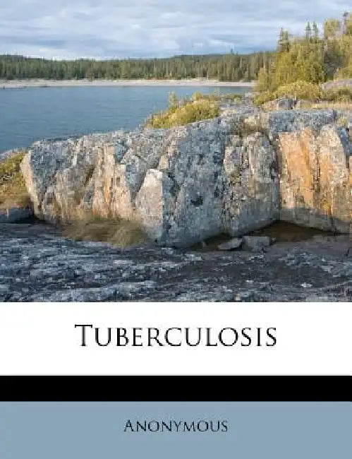 Tuberculosis by Anonymous