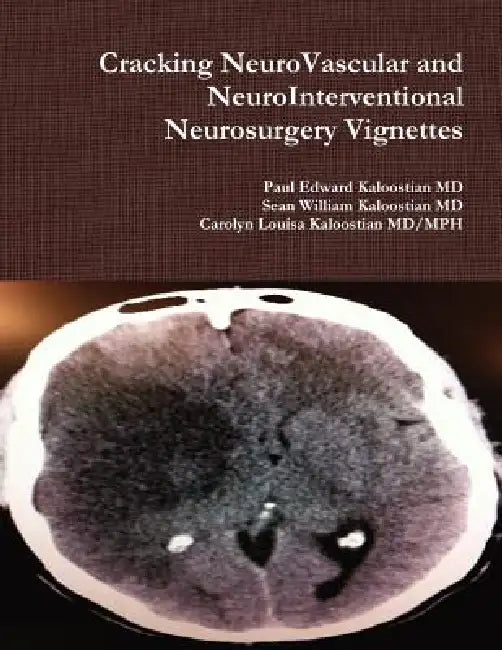 Cracking NeuroVascular and NeuroInterventional Neurosurgery Vignettes by Paul Edward Kaloostian, Carolyn Louisa Kaloostian MD/Mph, Sean William Kaloostian