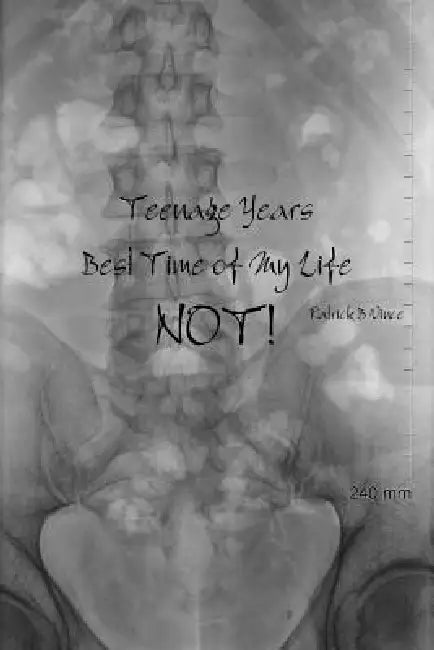 Teenage Years, Best Time of My Life. NOT! by Patrick B. Vince