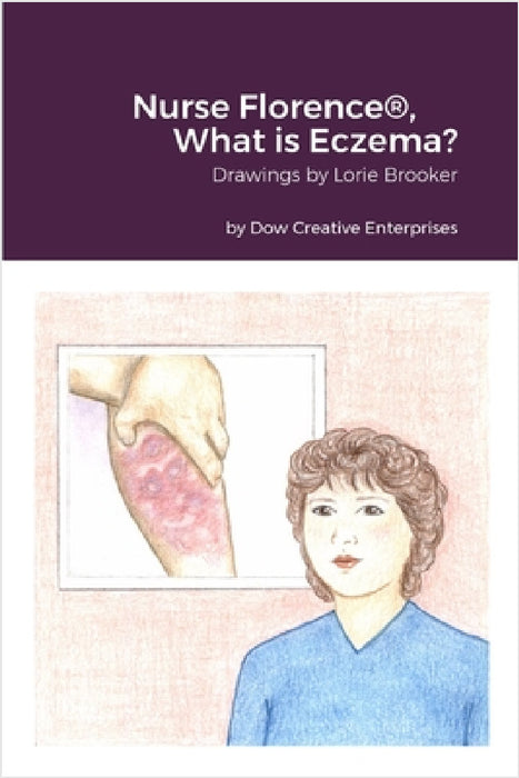 Nurse Florence(R), What is Eczema? by Michael Dow, Lorie Brooker
