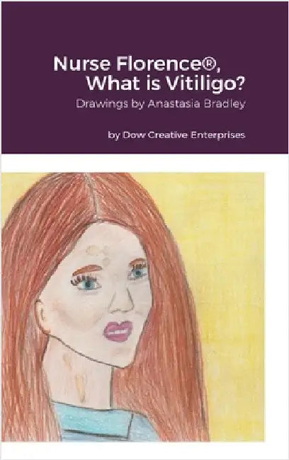 Nurse Florence(R), What is Vitiligo? by Dow, Michael