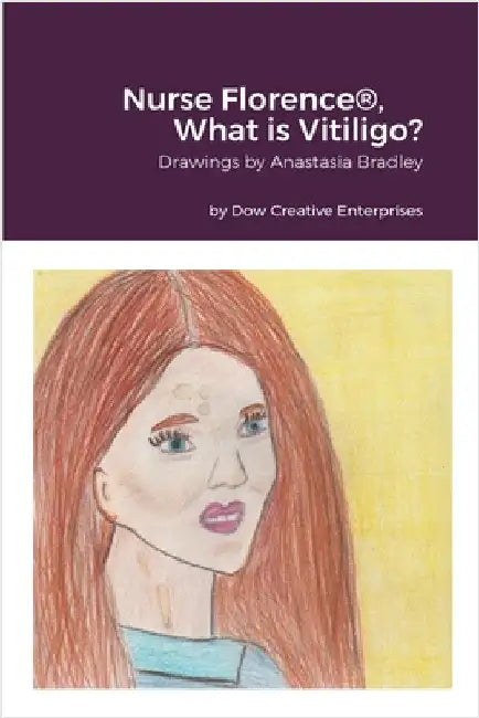 Nurse Florence(R), What is Vitiligo? by Dow, Michael