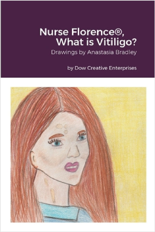 Nurse Florence(R), What is Vitiligo? by Michael Dow, Anastasia Bradley