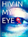 HIV in my Eye by Thomas Green