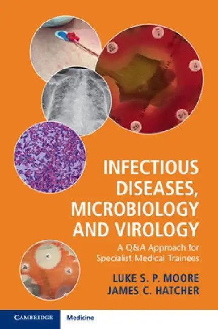 Infectious Diseases, Microbiology and Virology: A Q&A Approach for Specialist Medical Trainees by Luke S. P. (Imperial College London) Moore
