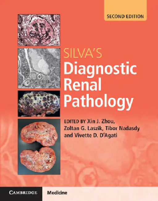 Silva's Diagnostic Renal Pathology by Zhou, Zoltan G. Laszik, Tibor Nadasdy