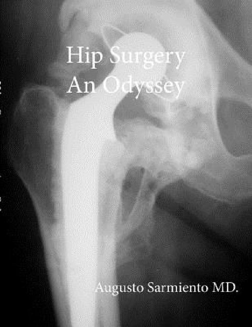 Hip Surgery - An Odyssey by Augusto Sarmiento
