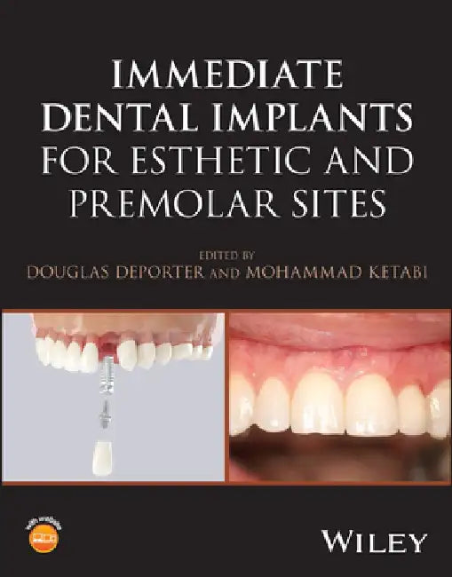Immediate Dental Implants for Esthetic and Premolar Sites by Douglas (University of Toronto, ON, Canada) Deporter