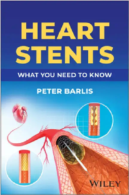 Heart Stents: What You Need to Know by Peter Barlis