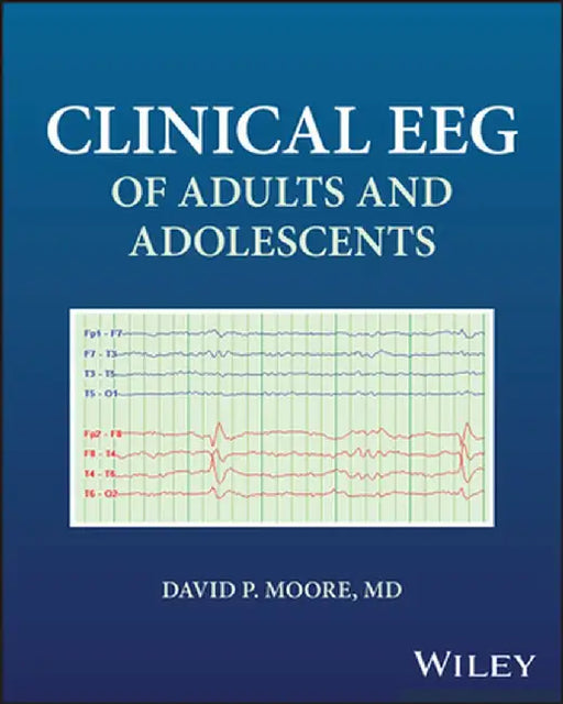 Clinical Eeg of Adults and Adolescents by David Moore