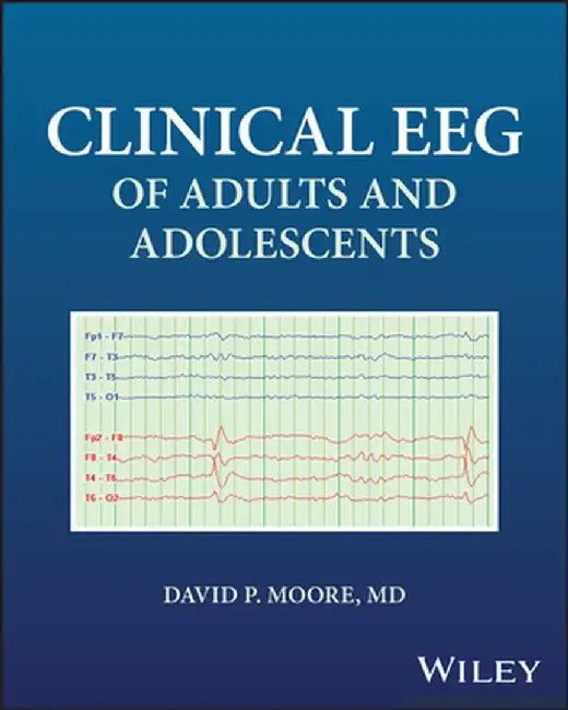 Clinical Eeg of Adults and Adolescents by David Moore