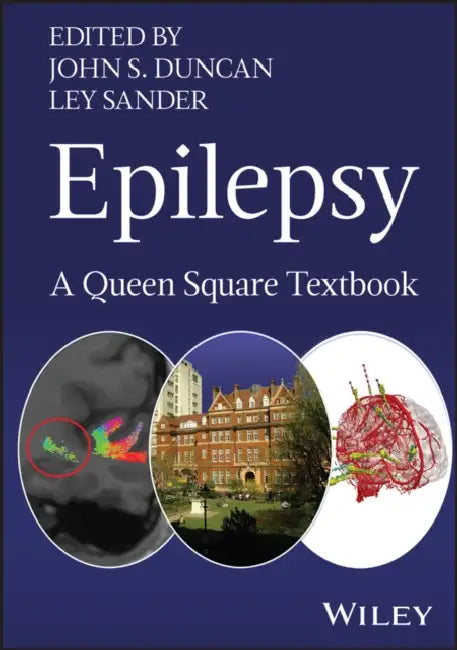 Epilepsy: A Queen Square Textbook by John S. Duncan, Ley Sander
