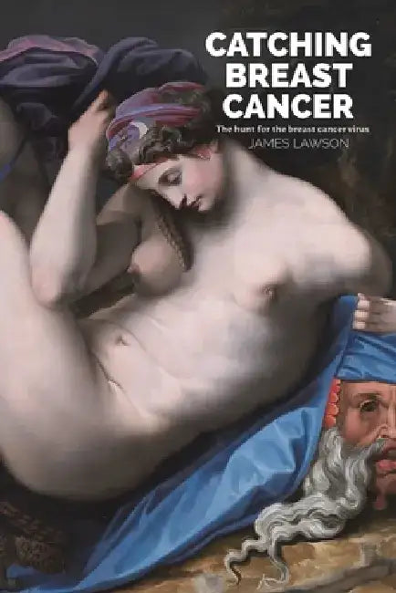 Catching Breast Cancer by James Lawson