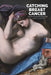 Catching Breast Cancer by James Lawson
