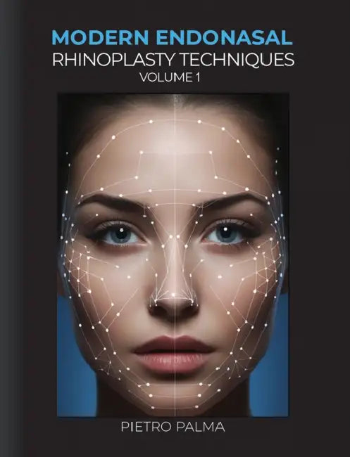 Modern Endonasal Rhinoplasty Techniques - Volume 1 by Pietro Palma, Ewa Jacob-Kadewska