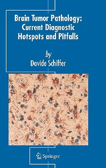 Brain Tumor Pathology: Current Diagnostic Hotspots and Pitfalls by Davide Schiffer