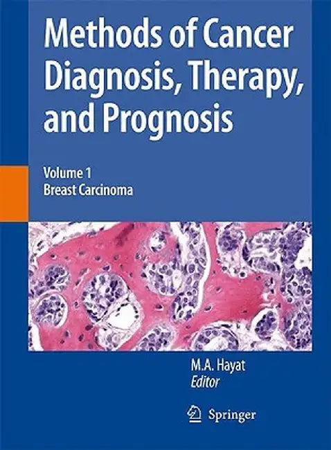Methods of Cancer Diagnosis, Therapy and Prognosis: Breast Carcinoma by M. A. Hayat