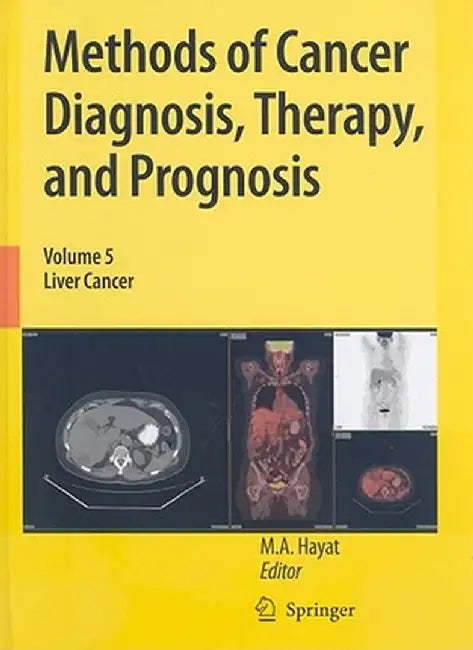 Liver Cancer by M. A. Hayat