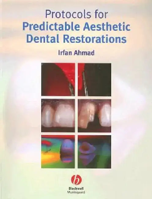 Protocols for Predictable Aesthetic Dental Restorations by Irfan Ahmad