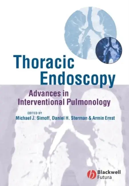 Thoracic Endoscopy: Advances in Interventional Pulmonology by Michael J. Simoff