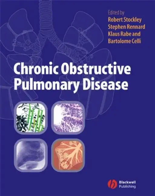 Chronic Obstructive Pulmonary Disease by Robert A. Stockley