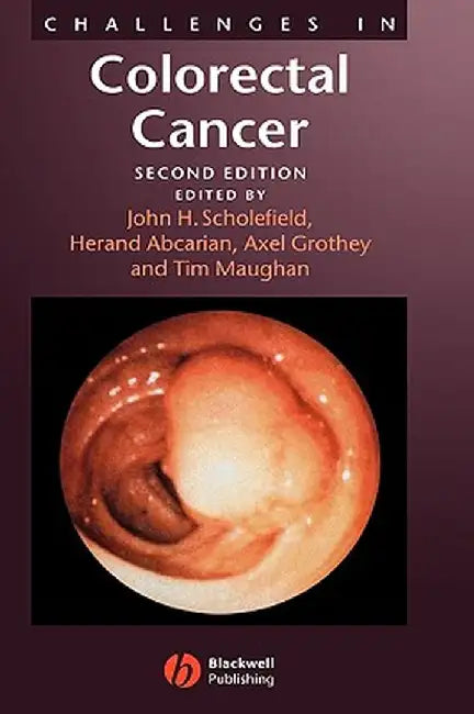 Challenges in Colorectal Cancer by John H. Scholefield
