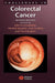 Challenges in Colorectal Cancer by John H. Scholefield