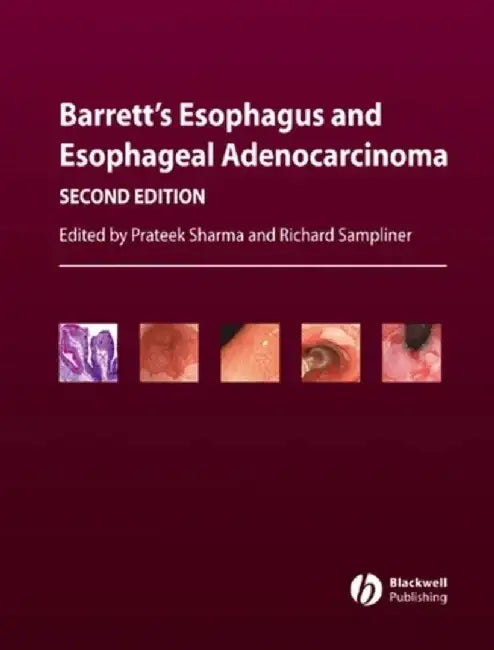 Barrett's Esophagus and Esophageal Adenocarcinoma, 2nd Edition by Editor: Prateek Sharma, Editor: Richard Sampliner