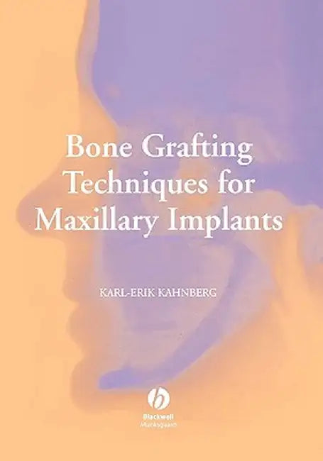 Bone Grafting Techniques for Maxillary Implants by Karl-Erik Kahnberg