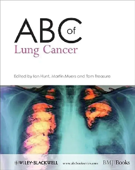 ABC of Lung Cancer by Ian Hunt