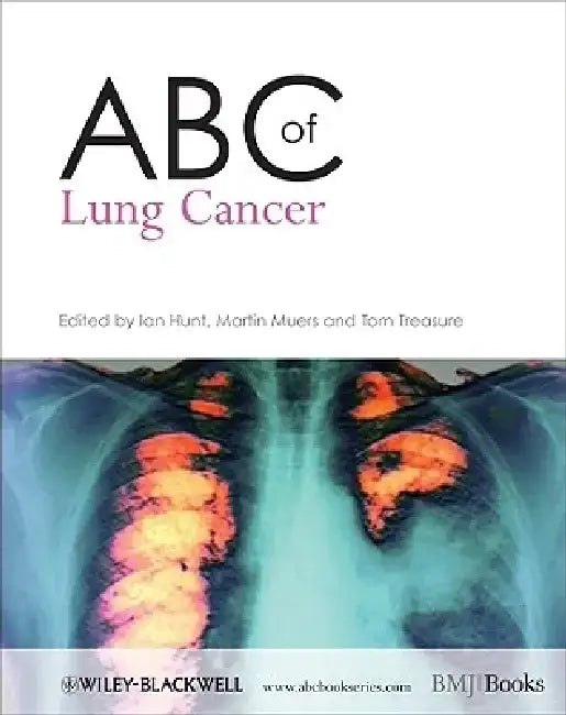 ABC of Lung Cancer by Ian Hunt