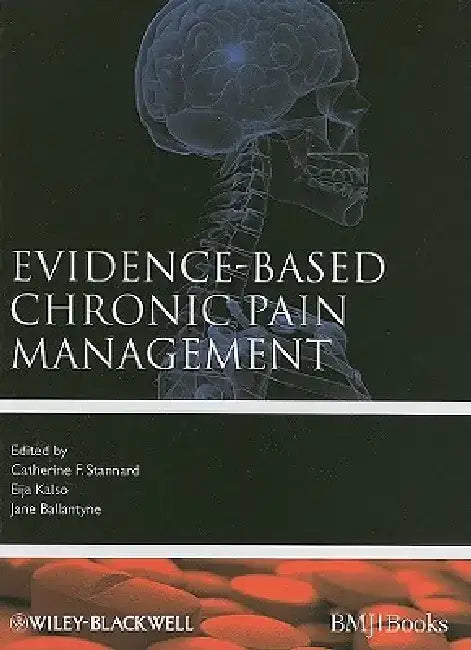Evidence-Based Chronic Pain Management by Cathy Stannard