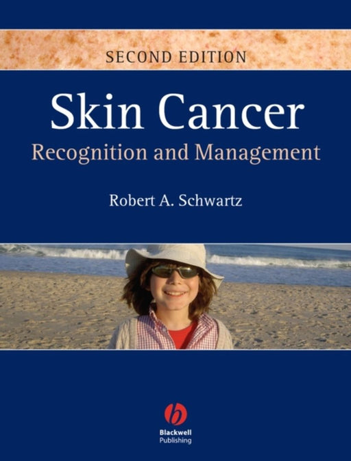 Skin Cancer: Recognition and Management by Robert A. Schwartz