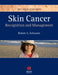 Skin Cancer: Recognition and Management by Robert A. Schwartz
