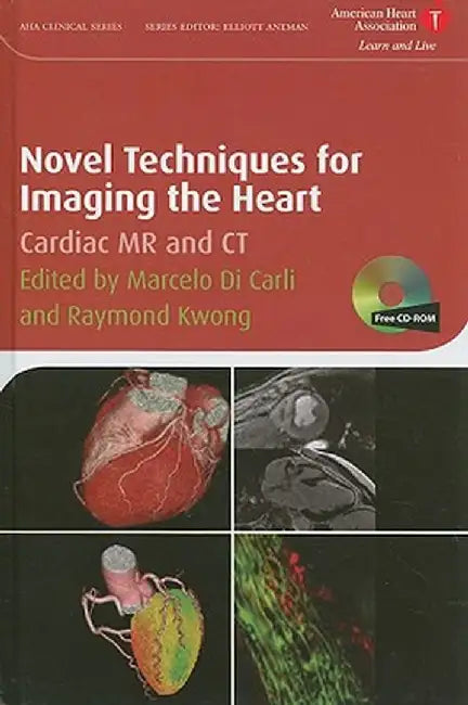 Novel Techniques For Imaging The Heart by Marcelo F. Di Carli, Raymond Y. Kwong