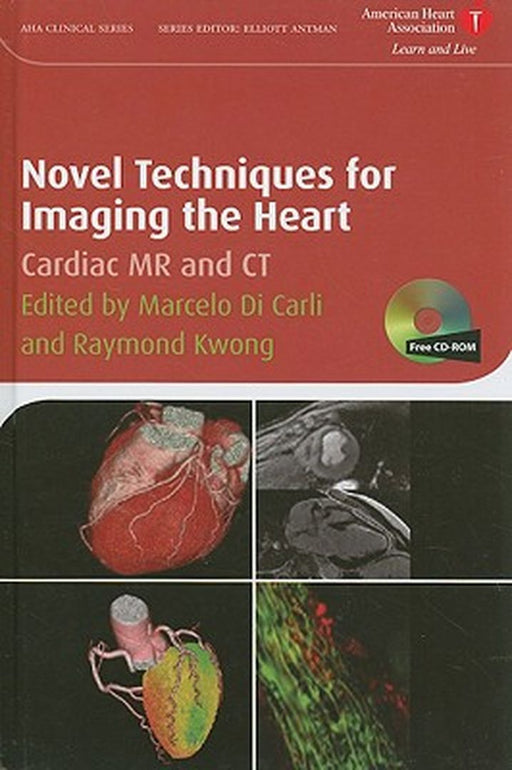 Novel Techniques For Imaging The Heart by Marcelo F. Di Carli, Raymond Y. Kwong
