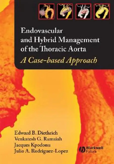 Endovascular and Hybrid Management of the Thoracic Aorta: A Case-Based Approach by Edward B. Diethrich