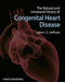 The Natural and Unnatural History of Congenital Heart Disease by Editor: Julien I. E. Hoffman